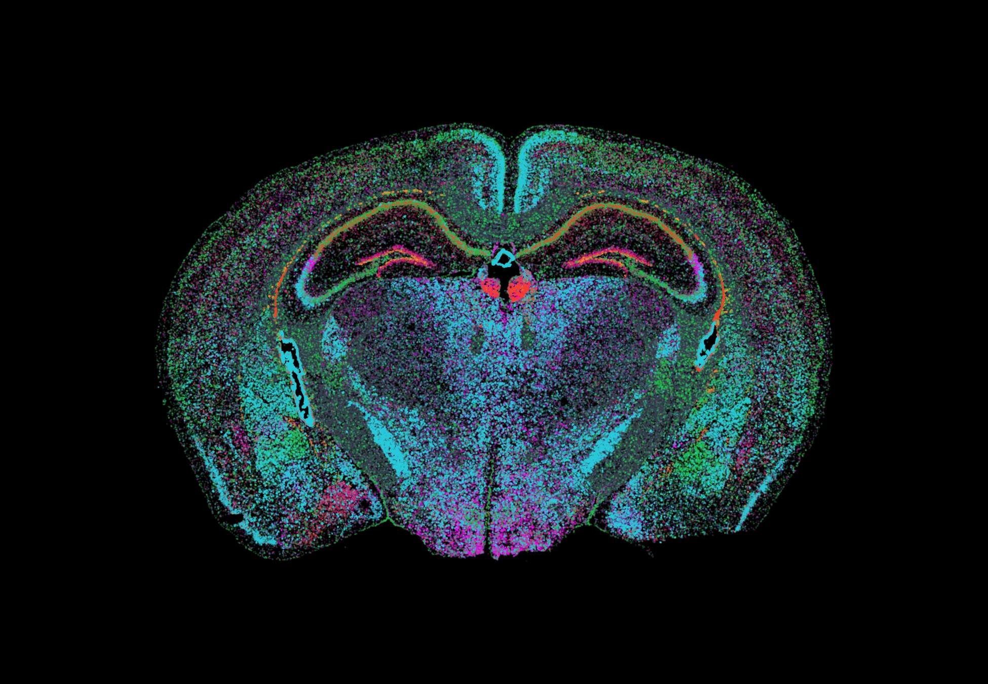 Spatial Transcriptomics التقنية الثورية الجديدة